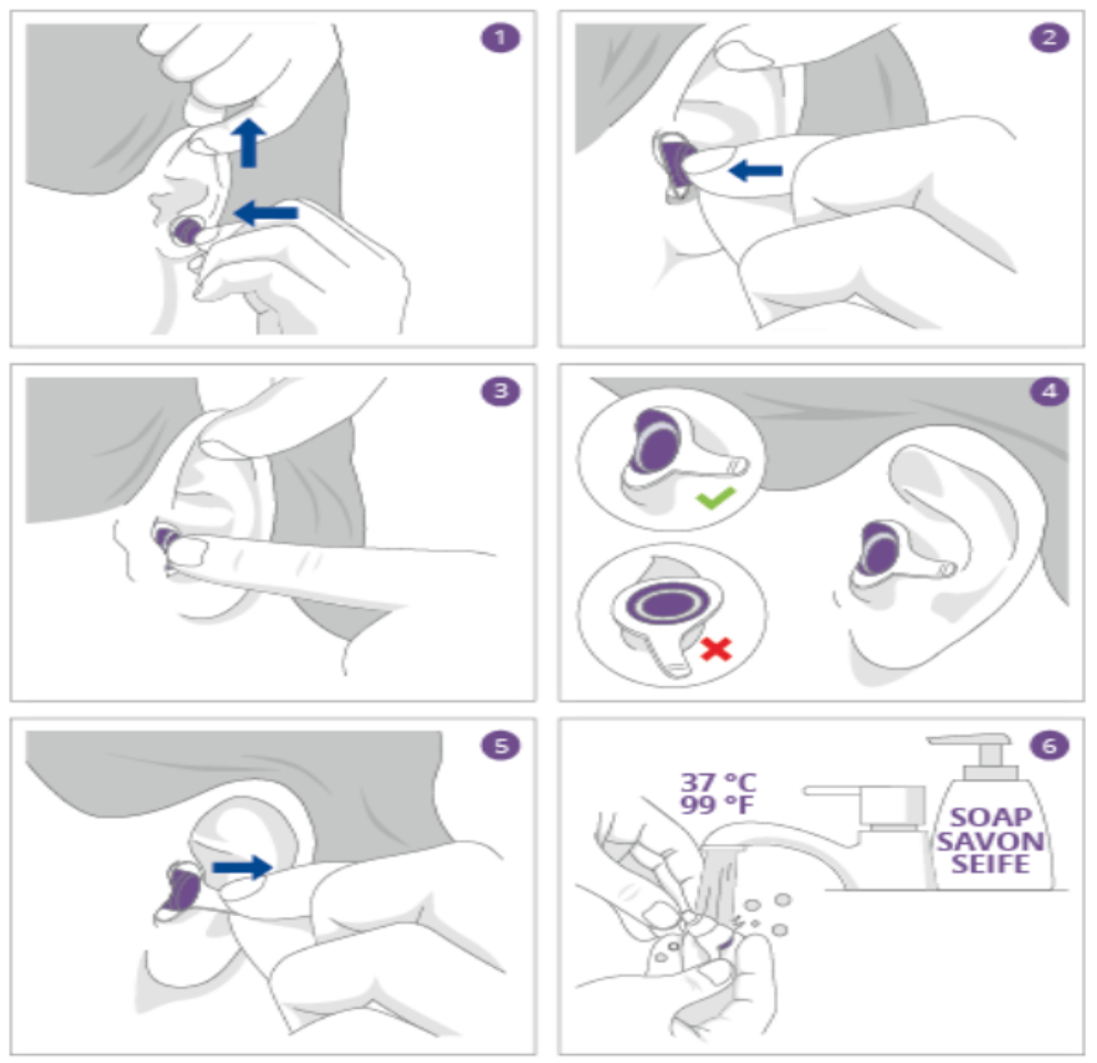 découvrez nos conseils pour faire le bon choix de bouchons d’oreilles adaptés à vos besoins : sommeil, voyage, musique ou protection au travail. trouvez la solution idéale pour préserver votre audition !