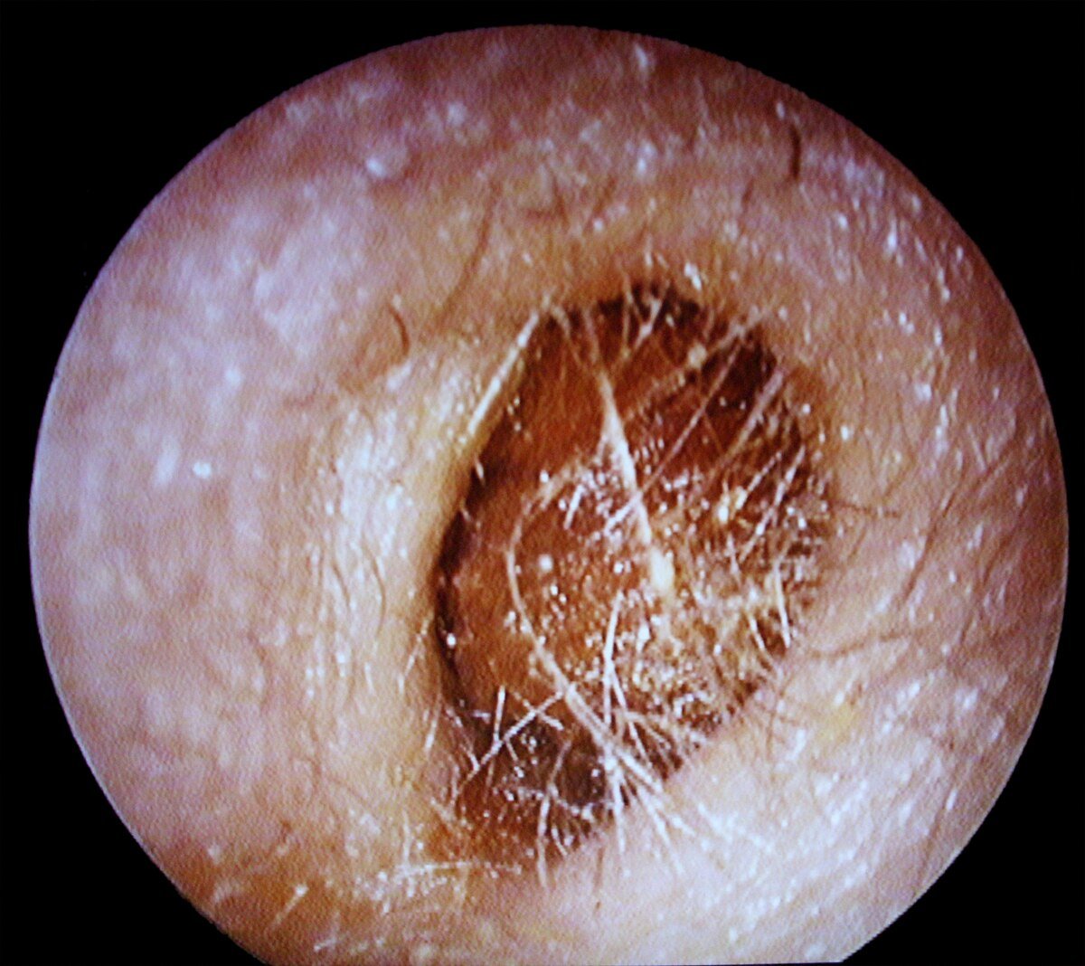 découvrez comment bien insérer des bouchons d'oreilles pour une protection optimale contre le bruit et préserver votre audition. conseils pratiques et étapes faciles.